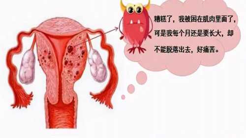 广州代孕子女监护权|女人做三代试管婴儿的过程痛苦吗？试管婴主要有哪几个