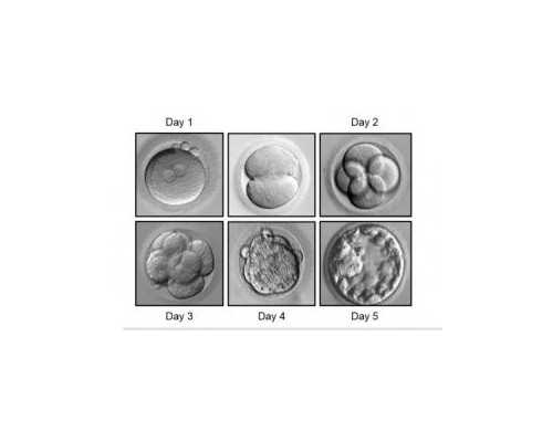 广州卵子库供卵费用清单?,广州金贝供卵多少钱-试管代怀官司