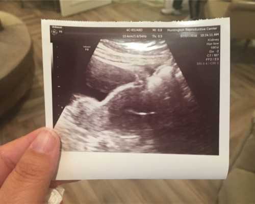 广州代生服务哪家好,广州代生网服务的概述