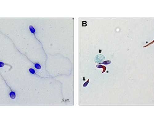 叶酸含量丰富的食物