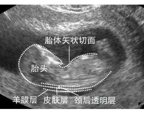 广州代孕代孕公司|盐城第三代试管婴儿多少