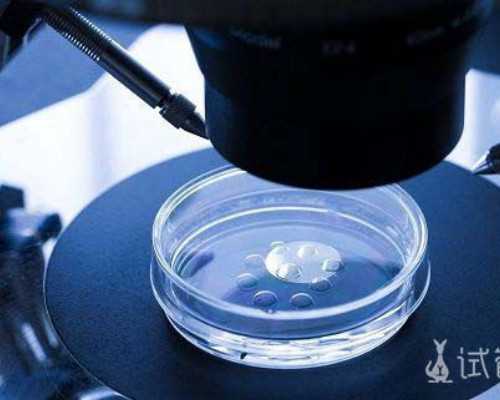 乌克兰多囊卵巢综合：多囊卵巢综合征性生活~代妈代怀