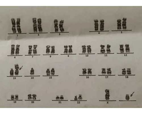 供卵多少钱广州公立医院,广州供卵公立医院简介