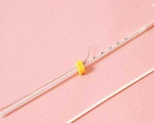 怎么改善多囊卵巢综合症有哪些调理方法~供卵包生