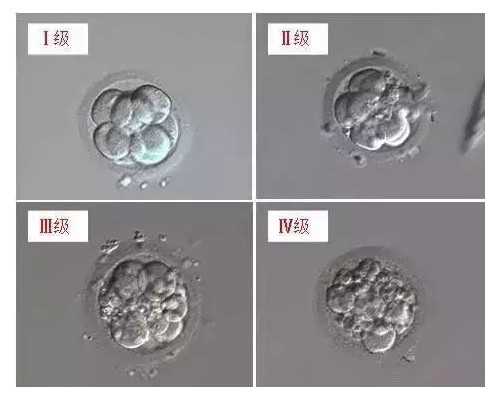 女性阴道炎症应该如何备孕？