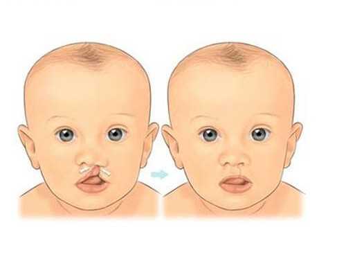 广州助孕机构代怀,试管放2个胚胎成功高吗-姑苏导致不孕不育去哪治_广州东吴