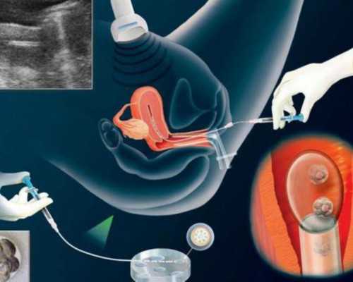 广州精子库的电话,广州精子库联系电话