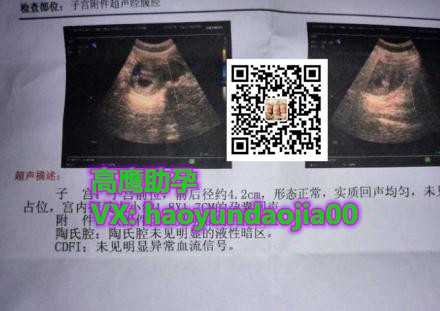 广州助孕公司哪家最靠谱,妊娠剧吐的病因分析